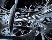 Bone Spicules within the Vertebral Body