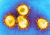 SARS Coronavirus,EM