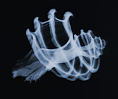 Murex seashell,X-ray