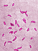 Vibrio cholerae bacteria,LM