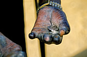 Hand of Leprous Man Begging