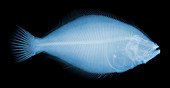 Flounder Fish,X-ray