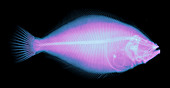 Flounder Fish,X-ray