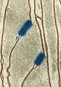 Desmosomes in an Invertebrate,TEM