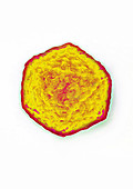 Hepatitis A Virus (HAV)