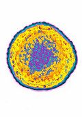 Hepatitis C virus (HCV)