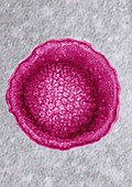 Herpes Simplex Virus (HSV1-HSV2)