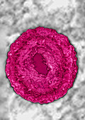 Cytomegalovirus (CMV - HSV5)