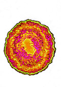 Cytomegalovirus (CMV - HSV5)