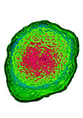Herpes Simplex Virus (HSV 6 & 7)