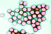 TEM of Rotavirus