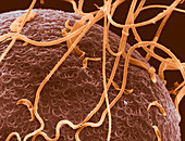 SEM of Human Sperm on Zona Pellucida