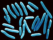Toxigenic Escherichia coli O145