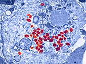 Smallpox Virus,TEM