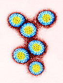 TEM of Rotavirus