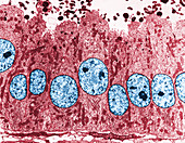 TEM of Vas Deferens