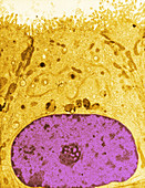 TEM of Epididymis