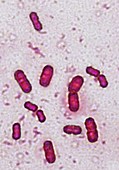 Moraxella Bacterium,LM