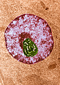 Glandular Cell Nucleus,TEM