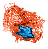 Dendritic Cell,TEM