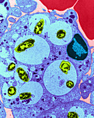 Neutrophil Ingesting Bacteria,TEM