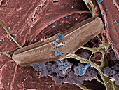 Diatom with Thermophilic Bacteria