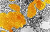 Beet Necrotic Yellow Virus,TEM