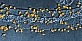 Escherichia Coli on a Cell Wall