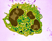 Human Neutrophil,TEM