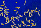 Diphtheria bacilli