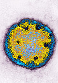 Lassa Virus