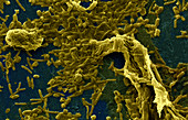 Legionella pneumophila (SEM)