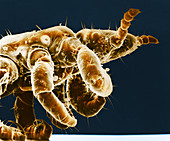 Human Head Louse,SEM