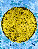 Leydig Cell,TEM