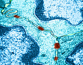 Desmosomes Between Epithelial Cells,TEM