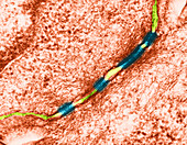 Desmosomes Between Epithelial Cells,TEM