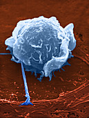 Macrophage,SEM