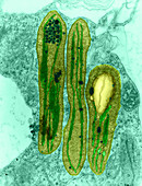 Chloroplasts,TEM