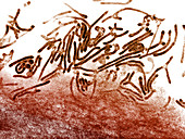 Mycoplasma Bacteria,LM