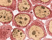 Human KB Cells,TEM