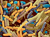 Toddler's Feces with Bifidobacteria,SEM