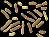 Toxigenic Escherichia Coli O121,SEM