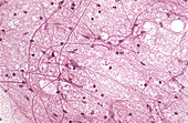 Neuron Smear