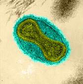 Smallpox Virus,TEM