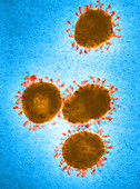 Infectious Bronchitis Virus,TEM