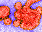 H3N2 Influenza Virus,TEM