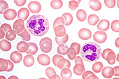 Neutrophils in Peripheral Blood Smear,LM