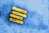 Broccoli Necrotic Yellow Virus,TEM