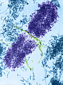 Chromosome with Microtubules,TEM
