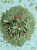 Tribec Virus,TEM